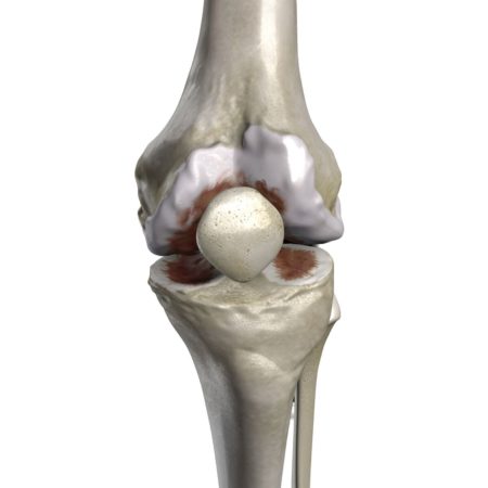 Healthy Knee Ii Preview